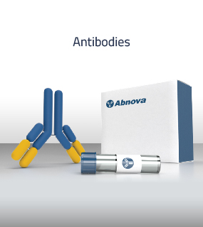 The Antibodies are primarily used in cell culture laboratories, clinical diagnostics, pharmaceuticals, and protein expression studies.